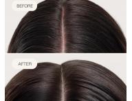 Spray bez sp�ukiwania nawil�aj�cy sk�r� g�owy Goldwell Dualsenses Scalp Specialist Rebalance & Hydrate Fluid - 150 ml