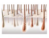 Seria do wosw przerzedzonych Goldwell DualSenses Scalp Specialist