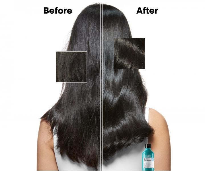 Szampon oczyszczajcy przeciwupieowy Loral Professionnel Scalp Advanced Anti-Dandruff - 500 ml