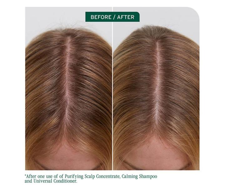 Przygotowuj�ca piel�gnacja oczyszczaj�ca do wszystkich rodzaj�w sk�ry g�owy Biolage Scalp Sync Purifying Scalp Concentrate - 200