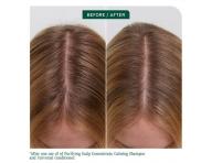 Seria produktw dla zdrowej skry gowy Matrix Biolage ScalpSync