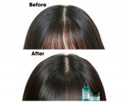 Produkty do pielgnacji skry gowy Loral Professionnel Scalp Advanced