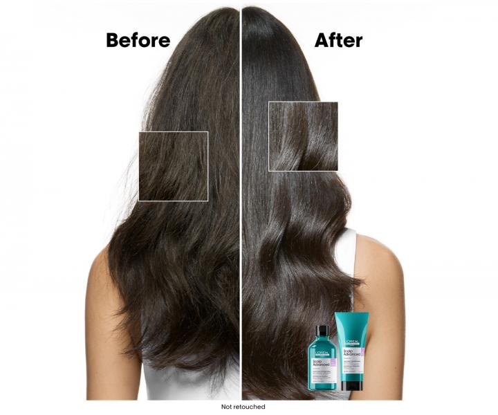 Produkty do pielgnacji skry gowy Loral Professionnel Scalp Advanced