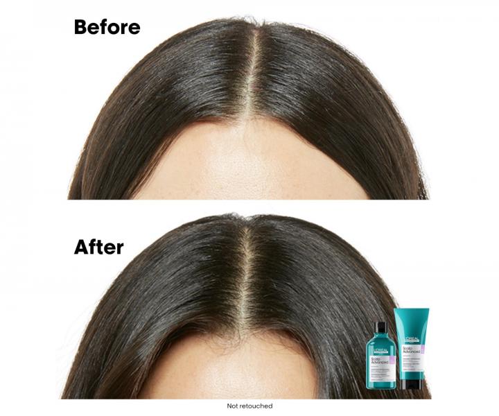 Produkty do pielgnacji skry gowy Loral Professionnel Scalp Advanced