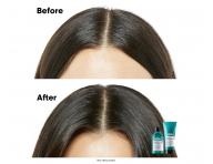 Produkty do pielgnacji skry gowy Loral Professionnel Scalp Advanced