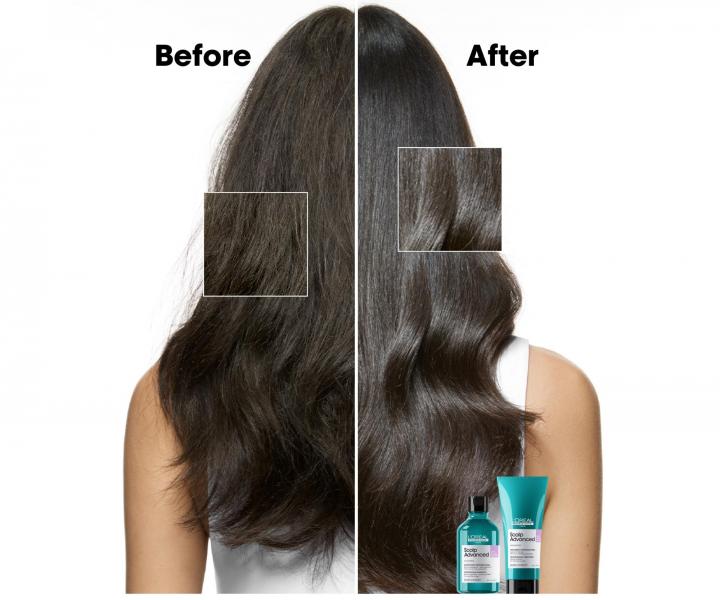 Szampon kojcy do wraliwej skry gowy Loral Professionnel Scalp Advanced Anti-Discomfort - 500 ml