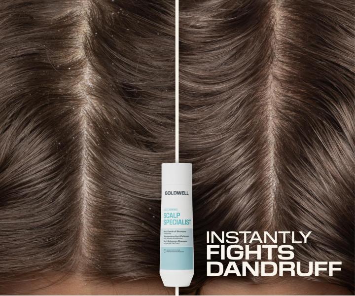 Szampon przeciw�upie�owy Goldwell Dualsenses Scalp Specialist Anti-Dandruff Shampoo - 250 ml
