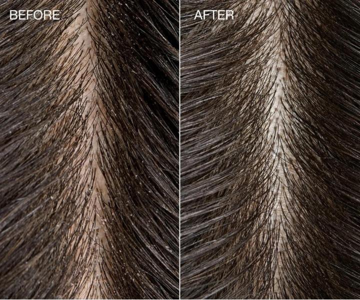 Serum detoksykujce do skry gowy Paul Mitchell Tea Tree Special Detox Kombucha Rinse