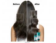 Produkty do pielgnacji skry gowy Loral Professionnel Scalp Advanced