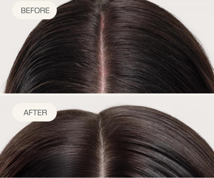 Spray bez sp�ukiwania nawil�aj�cy sk�r� g�owy Goldwell Dualsenses Scalp Specialist Rebalance & Hydrate Fluid - 150 ml